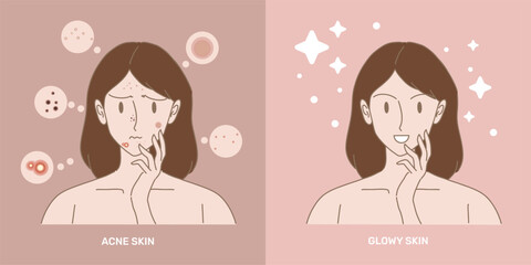 Face of woman with skin problem compare with healthy skin. Girl touching acne skin and glowy skin by hand. Hand drawn flat cartoon character vector illustration.