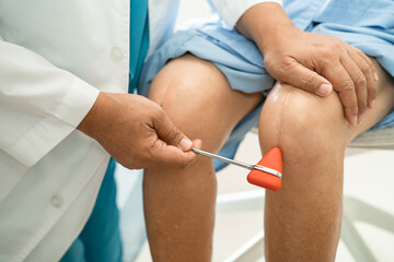 Asian doctor use hammer knock senior woman patient to check knee reflex, nerve and muscle in...