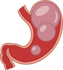 Bloating. Stomach disorder and disease, Gas problems. Vector Illustration of Human Internal Organs. Anatomy and Medicine