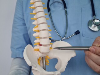 Doctor shows inflammation and pain in intervertebral discs hernia of displaced joints.