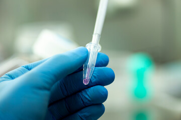 cell culture at the medicine  medical and cell culture laboratory