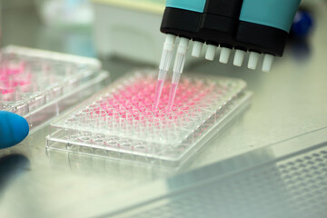 cell culture at the medicine  medical and cell culture laboratory