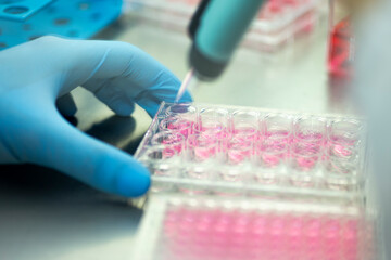 cell culture at the medicine  medical and cell culture laboratory