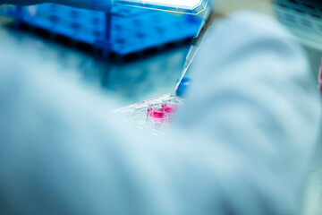 cell culture at the medicine  medical and cell culture laboratory