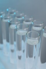 Laboratory analysis. Test tubes with liquid samples on color background, closeup