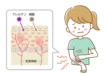 かゆみ　手を掻く女性  肌細胞
