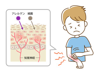 かゆみ　手を掻く男性  肌細胞