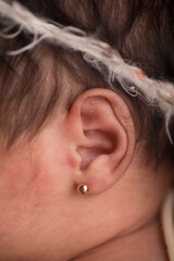 Naklejka premium Little newborn baby earlobe earring ear preauricular appendix listen