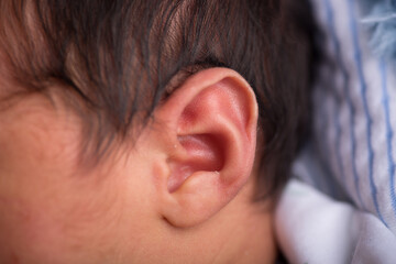 Little newborn baby earlobe earring ear preauricular appendix listen