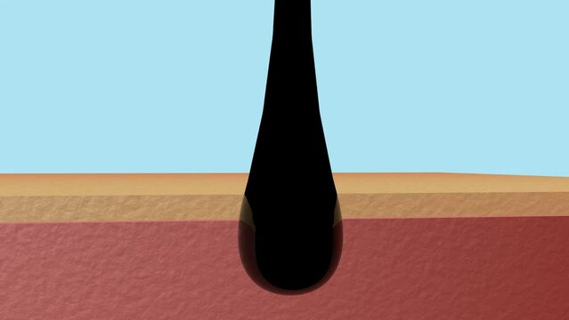 Hair follicles with oil bags and black threads on the skin 4K footage. Hair growing concept with a human skin 4K animation. Anatomical Hair growth phase and stages of the hair growth cycle animation.