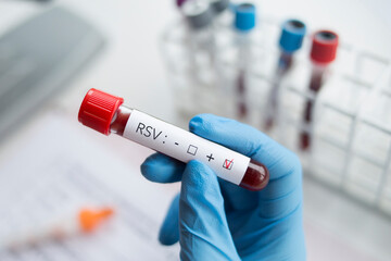 Positive laboratory blood test for the RSV virus. - obrazy, fototapety, plakaty