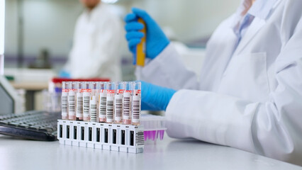Modern loborothyria. The scientist examines the test tubes and takes notes. Organized test tubes with scientific samples and substances in them, intended for scientific research.