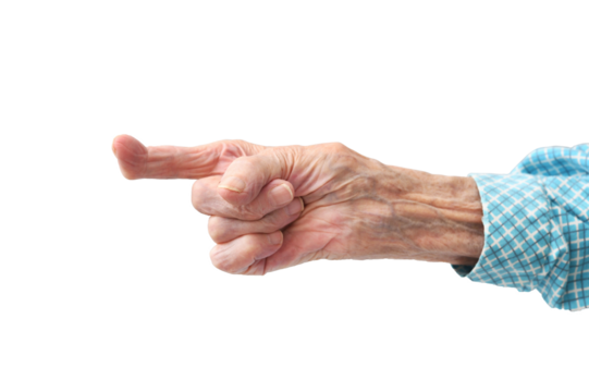 Rheumatoid polyarthritis of the hand of a 95 year old woman isolated on a white background. Crooked finger.