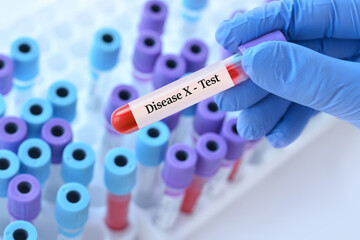 Doctor holding a test blood sample tube with Disease X test.The world is preparing for a new...