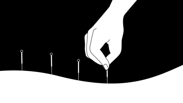 Hand of doctor performing acupuncture therapy. Alternative medicine concept, 2d Animation, cartoon, illustration in black and white, alpha channel.