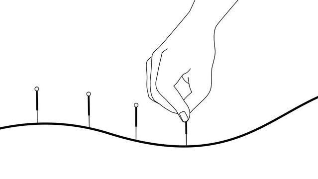 Hand of doctor performing acupuncture therapy. Alternative medicine concept, 2d Animation, cartoon, illustration in black and white, alpha channel.