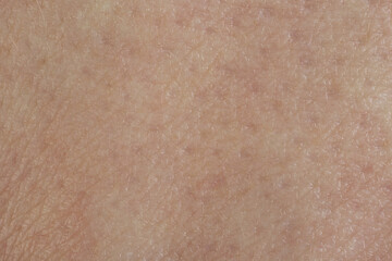 Texture of healthy skin as background, macro view