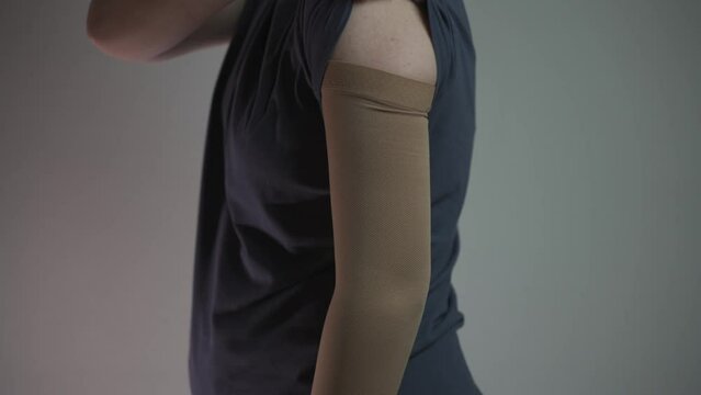 Medical hand compression stockings for treatment of varicose veins, thrombosis and thrombophlebitis. Compressive knitwear. Hospital compression sock on hand. Hand support for lymphedema, arthritis. 