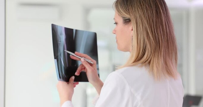Female surgeon thoughtfully learns X-ray image of broken leg