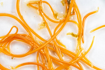 Study of Parasitic helminths (Trematodes) and Ascaris of fishes under a microscope.