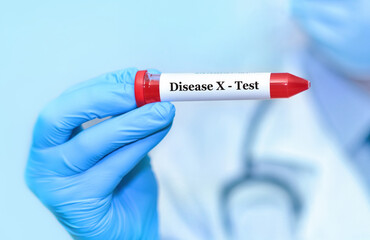 Fototapeta premium Doctor holding a test blood sample tube with Disease X test.The world is preparing for a new mysterious pandemic 
