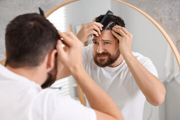 Dandruff problem. Man with comb examining his hair and scalp near mirror indoors
