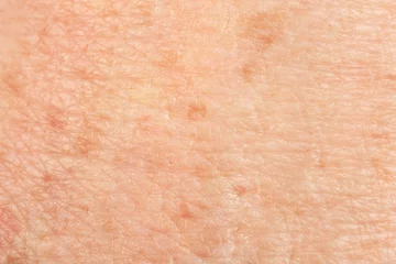 Fotobehang Texture of skin with pigmentation as background, macro view © New Africa