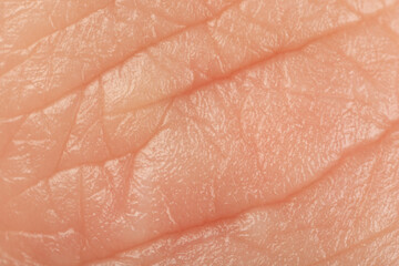 Texture of healthy skin as background, macro view