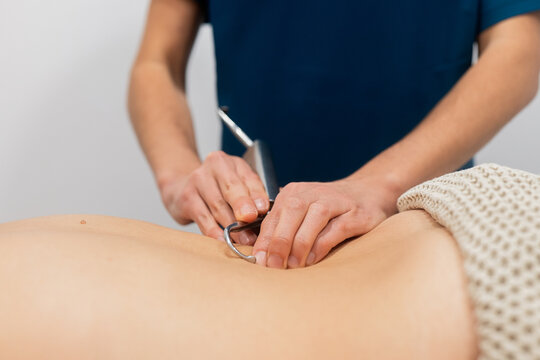 Physiotherapist performing dry needling technique on patient