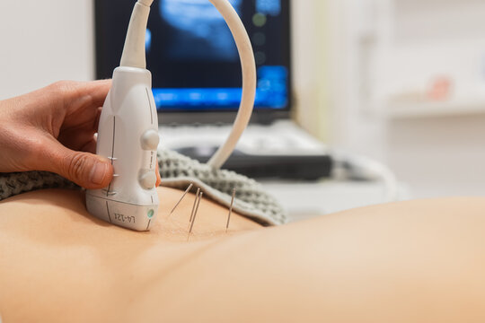 Ultrasound therapy alongside acupuncture for pain relief