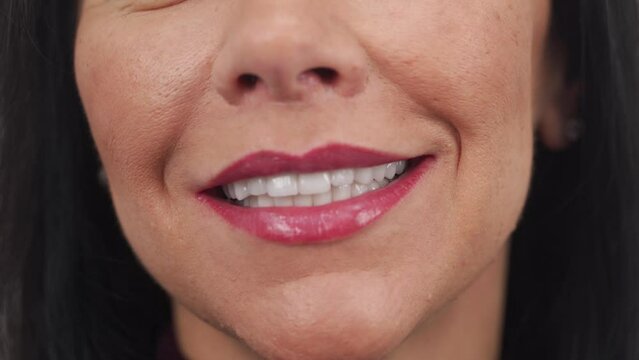 Close-up of woman's smile after installing zirconia veneers, dental ceramic crowns. Female patient smiling after cosmetic dental treatment of teeth by the porcelain veneers. Perfect hollywood smile.
