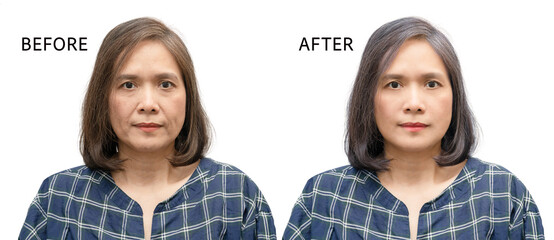 Asian woman middle aged portrait person before and after retouch wrinkles face skin processing...