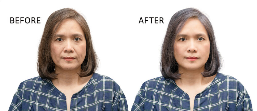 Asian woman middle aged portrait person before and after retouch wrinkles face skin processing isolated on white background, repair and treatment.