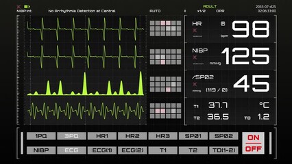 Vital Signs Monitor with Heart Rate and Other Medical Parameters on an Animated Mock-up. Patient's Vitals and ECG Graph for Intensive Care Unit Template for Computer Displays and Laptop Screens