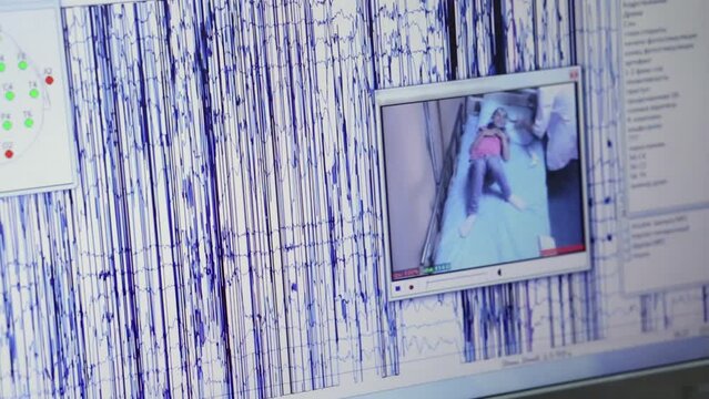 Screen with live charts, camera window on which girl and doctor 