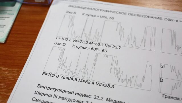 Printed results of encephalographic survey with charts 
