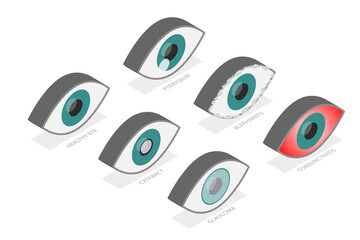 3D Isometric Flat  Set of Eyes with Different Problems, Human Eye and Vision Health