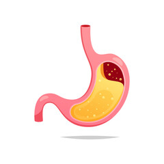 Gerd stomach vector isolated on white backrgound.
