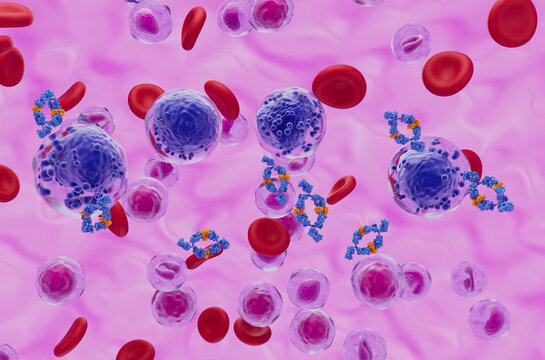 Monoclonal antibody treatment in Acute myeloid leukaemia (AML) - isometric view 3d illustration