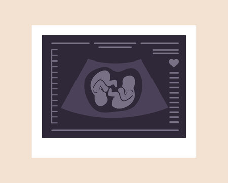 Ultrasound of twins. Embryos in womb. Pregnancy screening. Babies health diagnostic. Fetus silhouettes photo. Sonography or ultrasonography concept. Vector illustration in flat cartoon style.