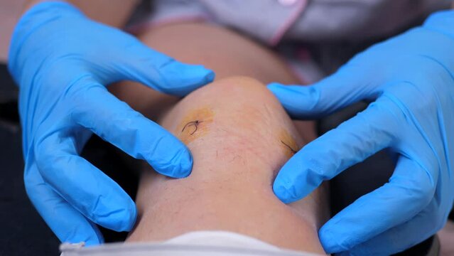 A nurse in sterile gloves is probing the patient's knee joint after arthroscopy surgery. Rehabilitation postoperative period.