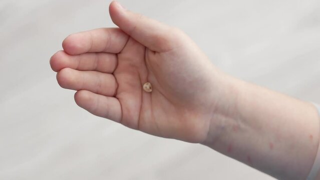 The child's palm opens, the child holds a baby tooth on the open palm, which fell out naturally. Preserves baby teeth.