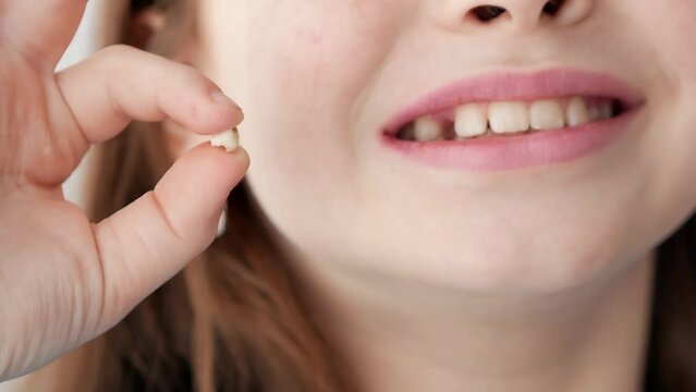 A Caucasian girl smiles broadly, showing a gap from a fallen baby tooth holding a fallen buz in her hand, the loss of the first premolar. Selective focus.