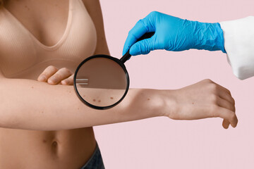 Dermatologist examining moles of young woman with magnifying glass on pink background, closeup