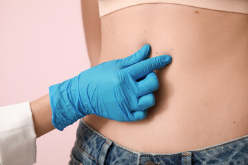 Dermatologist examining young woman with moles on pink background, closeup - obrazy, fototapety, plakaty