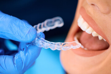 Close up of woman getting orthodontic teeth aligner during appointment at dentist's office.