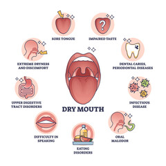 Dry mouth or xerostomia as salivary glands saliva problem outline diagram, transparent background. Labeled educational scheme with medical mouth condition, symptoms and causes illustration.