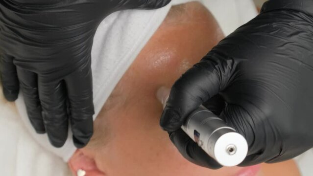 Close-up portrait of a beautiful aged woman during microneedling with dermapen from a beautician. Vertical video.
