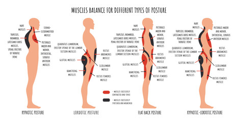 Comparison of muscle imbalance in various postural disorders. Kyphotic, lordotic, flat back posture infographics. The side view shows characteristic stretched and weakened, shortened and tens muscles - obrazy, fototapety, plakaty