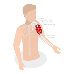 3D Isometric Flat  Conceptual Illustration of Tric Brachii Muscle, Human Anatomy